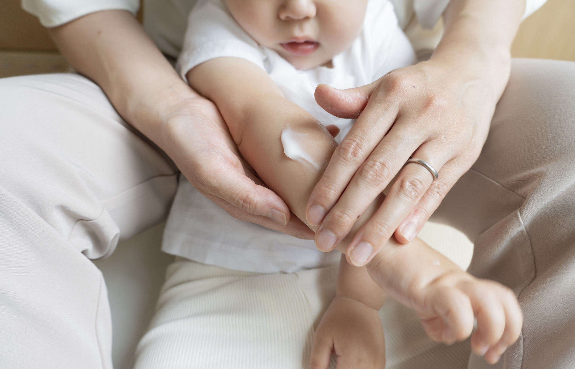 軟膏を塗られる子ども